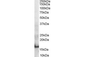 Western Blotting (WB) image for anti-SH2 Domain Containing 1A (SH2D1A) (Internal Region) antibody (ABIN2466265) (SH2D1A antibody  (Internal Region))