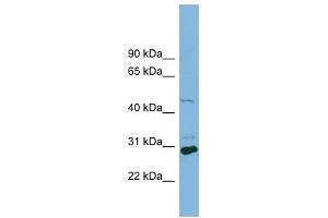 SLC16A1 antibody used at 1 ug/ml to detect target protein. (SLC16A1 antibody)