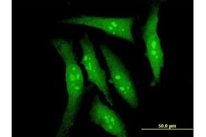 Immunofluorescence of monoclonal antibody to DYRK2 on HeLa cell. (DYRK2 antibody  (AA 1-100))