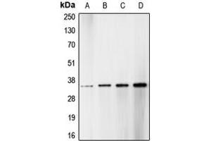 Western blot analysis of CDK1/2/3 (pT14) expression in HT29 hydroxyurea-treated (A), HeLa (B), NIH3T3 (C), A431 (D) whole cell lysates. (CDK1/2/3 (N-Term), (pSer14) antibody)