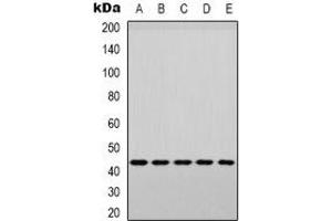 Western blot analysis of p38 (pY182) expression in PC3 (A), MCF7 (B), Raw264. (MAPK14 antibody  (pTyr182))