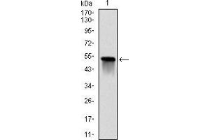 Western blot analysis using GSTM1 mAb against human GSTM1 (AA: 23-181) recombinant protein.