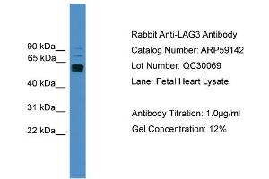 WB Suggested Anti-LAG3  Antibody Titration: 0.