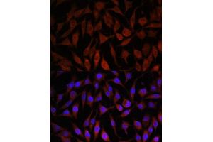 Immunofluorescence analysis of L929 cells using NEDD4L antibody (ABIN6132407, ABIN6144504, ABIN6144505 and ABIN6224109) at dilution of 1:100. (NEDD4-2 antibody  (AA 836-955))