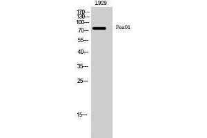 Western Blotting (WB) image for anti-Forkhead Box O1 (FOXO1) (Ser380) antibody (ABIN3184665) (FOXO1 antibody  (Ser380))