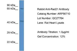 Western Blotting (WB) image for anti-RAD21 Homolog (RAD21) (C-Term) antibody (ABIN2786858) (RAD21 antibody  (C-Term))