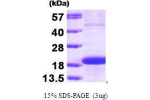 Figure annotation denotes ug of protein loaded and % gel used. (SKP1 Protein (AA 1-160))