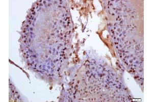 Formalin-fixed and paraffin embedded rat testis labeled with Anti-phospho-BCAR1(Tyr410) Polyclonal Antibody, Unconjugated (ABIN715991) at 1:200 followed by conjugation to the secondary antibody and DAB staining (BCAR1 antibody  (pTyr410))