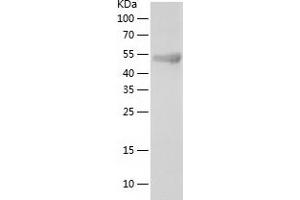 Western Blotting (WB) image for Torsin A Interacting Protein 2 (TOR1AIP2) (AA 2-214) protein (His tag) (ABIN7283174) (TOR1AIP2 Protein (AA 2-214) (His tag))