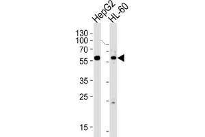 Western Blotting (WB) image for anti-Fanconi Anemia, Complementation Group C (FANCC) antibody (ABIN3004210) (FANCC antibody)
