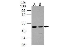 WB Image Sample (30 ug of whole cell lysate) A: JC B: C2C12 10% SDS PAGE antibody diluted at 1:1000 (IDH1 antibody  (Center))