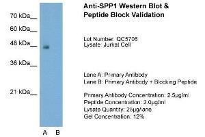 Host:  Rabbit  Target Name:  SPP1  Sample Type:  Jurkat  Lane A:  Primary Antibody  Lane B:  Primary Antibody + Blocking Peptide  Primary Antibody Concentration:  2.