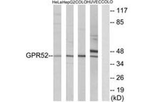 Western blot analysis of extracts from COLO/HuvEc/HeLa/HepG2 cells, using GPR52 Antibody. (GPR52 antibody  (AA 311-360))