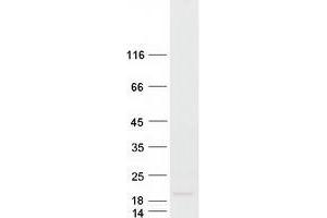 Validation with Western Blot (KISS1 Protein (Myc-DYKDDDDK Tag))
