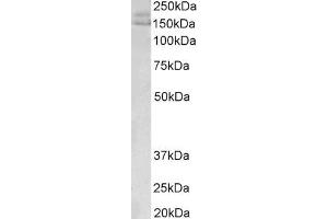 ABIN5539465(0. (AKAP12 antibody  (C-Term))
