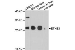Western blot analysis of extracts of various cell lines, using ETHE1 antibody (ABIN4903613) at 1:1000 dilution.