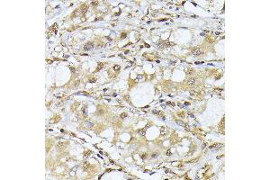 Immunohistochemistry (IHC) image for anti-Proteasome Subunit alpha  7 (PSMA7) (AA 1-248) antibody (ABIN1682332)