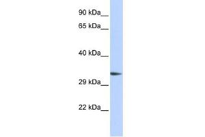 WB Suggested Anti-PACRG Antibody Titration: 0. (PACRG antibody  (Middle Region))