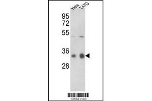 Western blot analysis of hPPP1CC-A306 in Hela, T47D cell line lysates (35ug/lane) (PPP1CC antibody  (C-Term))