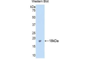 Detection of Recombinant ITIH4, Human using Polyclonal Antibody to Inter Alpha-Globulin Inhibitor H4 (ITIH4) (ITIH4 antibody  (AA 273-424))