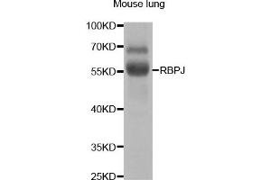 Western Blotting (WB) image for anti-Recombination Signal Binding Protein For Immunoglobulin kappa J Region (RBPJ) antibody (ABIN1876876) (RBPJ antibody)