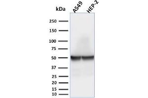 Western Blotting (WB) image for anti-Keratin 18 (KRT18) antibody (ABIN6939926)