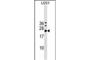 Western blot analysis in U251 cell line lysates (35ug/lane). (EXOSC4 antibody  (AA 69-96))
