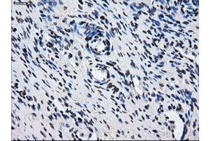 Immunohistochemical staining of paraffin-embedded colon tissue using anti-HDAC10mouse monoclonal antibody. (HDAC10 antibody)