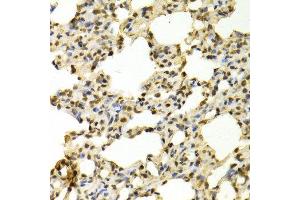 Immunohistochemistry (IHC) image for anti-Peptidyl Arginine Deiminase, Type IV (PADI4) (AA 1-250) antibody (ABIN3015692) (PAD4 antibody  (AA 1-250))