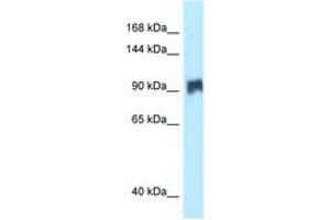 Image no. 1 for anti-Salt-Inducible Kinase 2 (SIK2) (AA 281-330) antibody (ABIN6747898) (SIK2 antibody  (AA 281-330))
