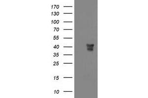 Western Blotting (WB) image for anti-Musashi Homolog 1 (Drosophila) (MSI1) antibody (ABIN1499571)