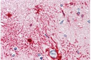 Anti-FABP7 / BLBP antibody IHC staining of human brain, cortex. (FABP7 antibody  (AA 1-132))