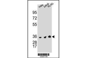 TYSY Antibody (C-term) A western blot analysis in Hela,Jurkat and HL-60 cell line lysates (35 μg/lane). (TYMS antibody  (C-Term))