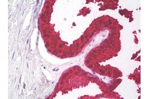 Anti-PSA antibody IHC of human prostate. (Prostate Specific Antigen antibody)