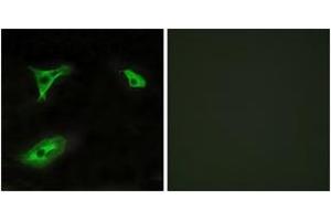 Immunofluorescence analysis of HeLa cells, using GPR116 Antibody. (G Protein-Coupled Receptor 116 antibody  (AA 11-60))