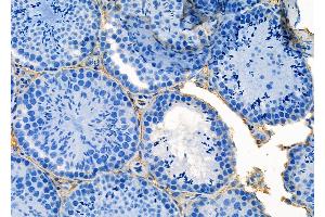 ABIN6264958 and ABIN6273159 at 1/100 staining Mouse testis tissue by IHC-P. (SEC24A antibody  (Internal Region))