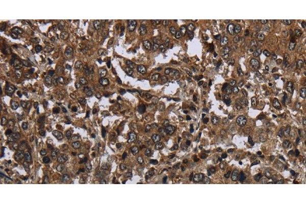GLIPR1 antibody