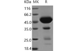 Western Blotting (WB) image for C-Type Lectin Domain Family 2, Member D (CLEC2D) protein (Fc Tag) (ABIN7321164)