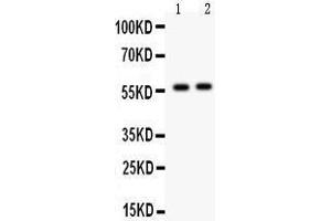 Observed bind size: 58KD (CYP7A1 antibody  (AA 301-504))