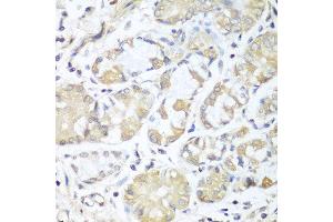 Immunohistochemistry of paraffin-embedded human stomach using RPH3AL antibody at dilution of 1:100 (40x lens).