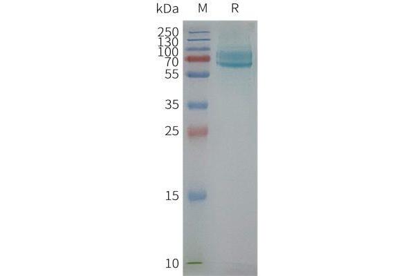 CD39 Protein