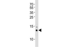 Western blot analysis of lysate from mouse Neuro-2a cell line using SUMO-1 antibody at 1:1000 for each lane. (SUMO1 antibody  (AA 1-30))