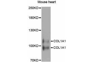 Western blot analysis of extracts of mouse heart, using COL1A1 antibody. (COL1A1 antibody)