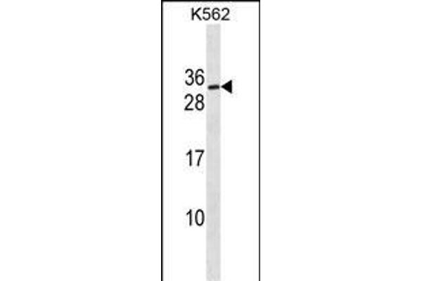 SSX3 Antikörper  (AA 53-80)
