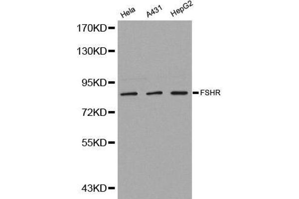 FSHR antibody  (AA 631-695)