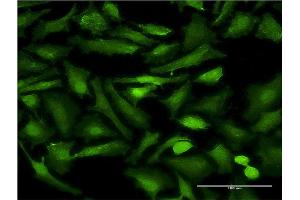 Immunofluorescence of monoclonal antibody to EHD2 on HeLa cell. (EHD2 antibody  (AA 365-427))