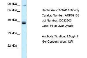 Western Blotting (WB) image for anti-T-Cell Activation rho GTPase-Activating Protein (TAGAP) (N-Term) antibody (ABIN2789039)