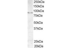 Western Blotting (WB) image for anti-A Kinase (PRKA) Anchor Protein 3 (AKAP3) (C-Term) antibody (ABIN2465380) (AKAP3 antibody  (C-Term))