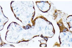Immunohistochemistry of paraffin-embedded Human placenta using CSNK1A1 Polyclonal Antibody at dilution of 1:100 (40x lens). (CSNK1A1 antibody)