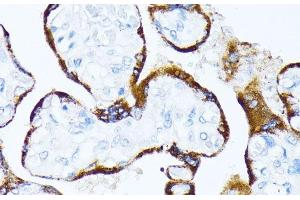 Immunohistochemistry of paraffin-embedded Human placenta using CSNK1A1 Polyclonal Antibody at dilution of 1:100 (40x lens). (CSNK1A1 antibody)